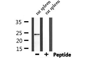 Western blot analysis of extracts from rat spleen, using IL-6 Antibody.