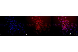 Immunofluorescence (fixed cells) (IF/ICC) image for anti-Superoxide Dismutase 2, Mitochondrial (SOD2) antibody (APC) (ABIN2484763)