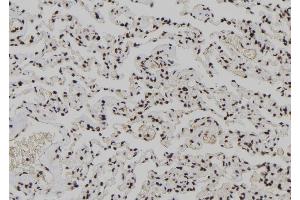 ABIN6278212 at 1/100 staining Human lung tissue by IHC-P. (XPO4 Antikörper  (N-Term))