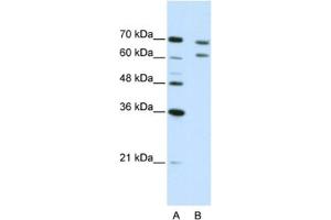 Western Blotting (WB) image for anti-Cleavage and Polyadenylation Specific Factor 3, 73kDa (CPSF3) antibody (ABIN2462266) (CPSF3 Antikörper)