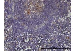 Image no. 1 for anti-PCNA Clamp Associated Factor (PAF) (AA 1-112) antibody (ABIN599096) (KIAA0101 Antikörper  (AA 1-112))