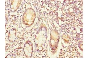 Immunohistochemistry of paraffin-embedded human small intestine tissue using ABIN7152363 at dilution of 1:100