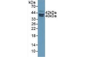 Detection of PAI2 in Human MCF7 Cells using Polyclonal Antibody to Plasminogen Activator Inhibitor 2 (PAI2) (SERPINB2 Antikörper  (AA 154-408))