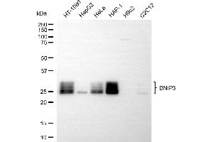 Western blotting analysis using BNIP3 antibody (ABIN7797758).