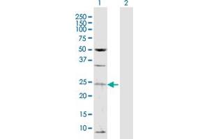 Western Blot analysis of TAF13 expression in transfected 293T cell line by TAF13 MaxPab polyclonal antibody. (TAF13 Antikörper  (AA 1-124))