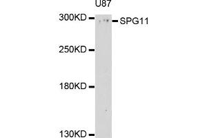 Western blot analysis of extract of U87 cells, using SPG11 antibody. (SPG11 Antikörper)