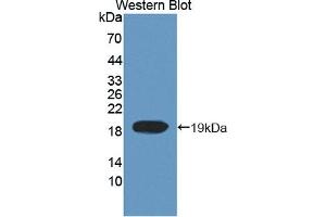 Detection of Recombinant TOP3, Human using Polyclonal Antibody to Topoisomerase III (TOP3) (TOP3 Antikörper  (AA 35-179))