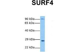 Host:  Rabbit  Target Name:  SURF4  Sample Tissue:  Human Stomach Tumor  Antibody Dilution:  1. (Surfeit 4 Antikörper  (N-Term))
