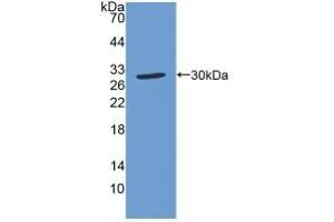 Detection of Recombinant SOD4, Human using Polyclonal Antibody to Superoxide Dismutase Copper Chaperone (Superoxide dismutase copper chaperone Antikörper  (AA 23-269))