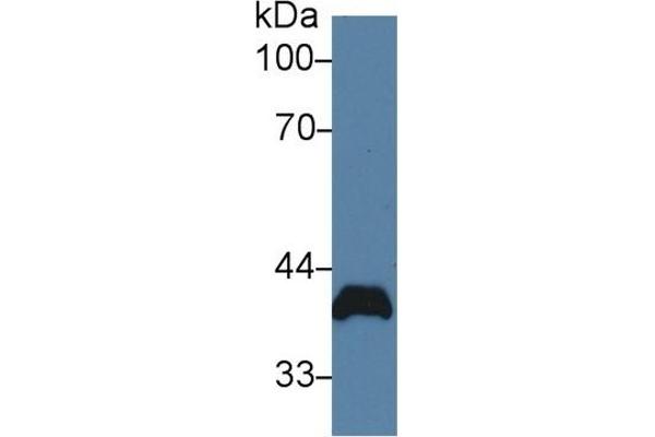 Poliovirus Receptor Antikörper  (AA 22-255)