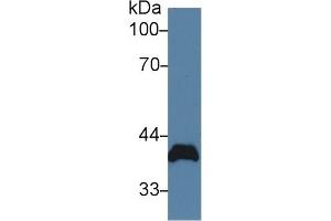 Detection of PVR in Rat Heart lysate using Polyclonal Antibody to Poliovirus Receptor (PVR) (Poliovirus Receptor Antikörper  (AA 22-255))