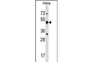CRT Antibody (N-term) 17060a western blot analysis in Hela cell line lysates (35 μg/lane). (CRTAP Antikörper  (N-Term))