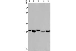 Western Blotting (WB) image for anti-Enoyl CoA Hydratase, Short Chain, 1, Mitochondrial (ECHS1) antibody (ABIN2423345) (ECHS1 Antikörper)