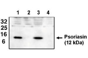 Image no. 1 for anti-S100 Calcium Binding Protein A7 (S100A7) antibody (ABIN264929) (S100A7 Antikörper)
