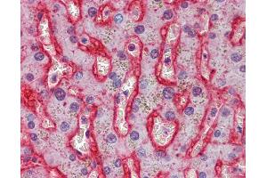 Immunohistochemistry (IHC) image for anti-Solute Carrier Family 2 (Facilitated Glucose Transporter), Member 2 (SLC2A2) (AA 277-290) antibody (ABIN574103)