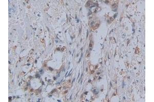 Immunohistochemistry (IHC) image for anti-Chemokine (C-C Motif) Ligand 2 (CCL2) (AA 24-99) antibody (ABIN7425674)