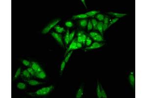 Immunofluorescence staining of Hela cells with ABIN7155395 at 1:200, counter-stained with DAPI.