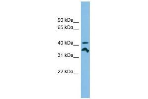 RRAGC antibody used at 1 ug/ml to detect target protein. (GTR2 Antikörper  (N-Term))