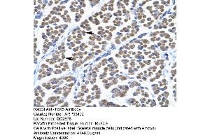 Immunohistochemistry (IHC) image for anti-T-Box 5 (TBX5) (Middle Region) antibody (ABIN2777914)