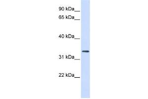Western Blotting (WB) image for anti-F-Box Protein 25 (FBXO25) antibody (ABIN2458708) (FBXO25 Antikörper)