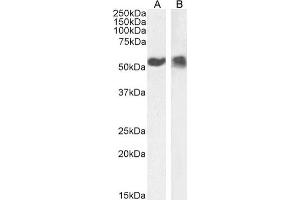 Western Blot using anti-p53 antibody PAb42. (Rekombinanter p53 Antikörper  (AA 371-380))