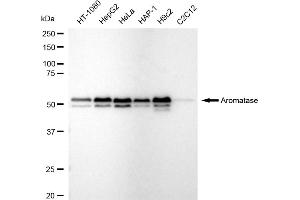 Western blotting analysis using Aromatase antibody (ABIN7798252).