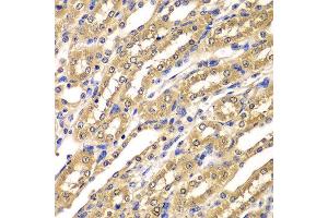Immunohistochemistry of paraffin-embedded mouse kidney using UBA3 antibody at dilution of 1:100 (x400 lens).