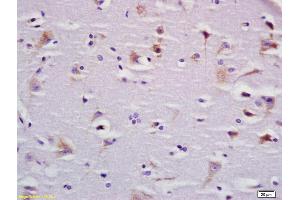 Formalin-fixed and paraffin embedded rat brain labeled with Anti-BBS9 Polyclonal Antibody, Unconjugated (ABIN1387812) at 1:200 followed by conjugation to the secondary antibody and DAB staining