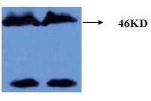 Western Blotting (WB) image for anti-Microtubule-Associated Protein tau (MAPT) (AA 177-187), (pThr181) antibody (ABIN1108152) (MAPT Antikörper  (pThr181))