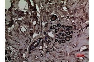 Immunohistochemistry (IHC) image for anti-Solute Carrier Family 6 (Amino Acid Transporter), Member 14 (Slc6a14) (C-Term) antibody (ABIN3187658)