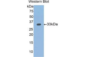 Western blot analysis of the recombinant protein. (SLIT1 Antikörper  (AA 345-623))