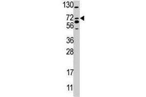 Western blot analysis of SMURF2 polyclonal antibody  in 293 cell line lysate (35 ug/lane). (SMURF2 Antikörper  (AA 702-731))