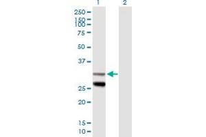 Western Blot analysis of SCO1 expression in transfected 293T cell line by SCO1 MaxPab polyclonal antibody. (SCO1 Antikörper  (AA 1-301))