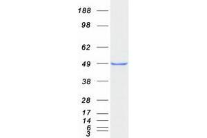 Western Blotting (WB) image for Doublecortin (DCX) (Transcript Variant 2) protein (Myc-DYKDDDDK Tag) (ABIN2719682)