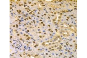 Immunohistochemistry of paraffin-embedded Rat kidney using COPS5 Polyclonal Antibody at dilution of 1:100 (40x lens). (COPS5 Antikörper)