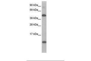 Image no. 1 for anti-Ligand Dependent Nuclear Receptor Corepressor (Lcor) (N-Term) antibody (ABIN6736069) (Lcor Antikörper  (N-Term))