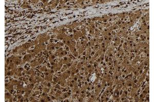 ABIN6278751 at 1/100 staining Human liver tissue by IHC-P. (CT47A1 Antikörper)