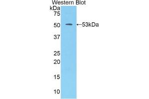 Western blot analysis of the recombinant protein. (Kallikrein 7 Antikörper  (AA 23-253))