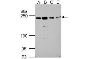 WB Image Sample (30 ug of whole cell lysate) A: A549 B: H1299 C: HCT116 D: MCF-7 5% SDS PAGE antibody diluted at 1:1000 (SLK Antikörper)