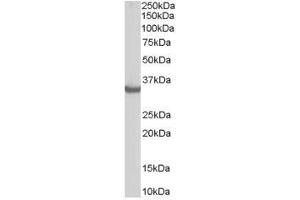 Image no. 1 for anti-STIP1 Homology and U-Box Containing Protein 1 (STUB1) (C-Term) antibody (ABIN374173) (STUB1 Antikörper  (C-Term))