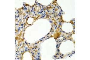 Immunohistochemistry of paraffin-embedded rat lung using IL9 antibody (ABIN3015677, ABIN3015678, ABIN1680463 and ABIN6219030) at dilution of 1:200 (40x lens). (IL-9 Antikörper  (AA 19-144))
