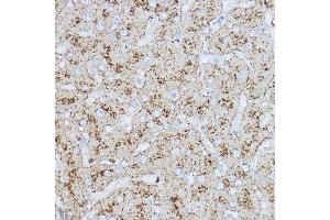 Immunohistochemistry of paraffin-embedded human liver using L Rabbit pAb (ABIN6129969, ABIN6143081, ABIN6143082 and ABIN6218224) at dilution of 1:200 (40x lens). (LAMP2 Antikörper  (AA 30-300))