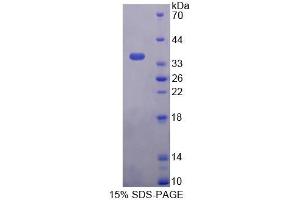 SDS-PAGE analysis of Human PNPO Protein. (PNPO Protein)