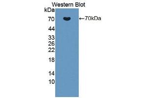 Western blot analysis of the recombinant protein. (TJP1 Antikörper  (AA 23-502))