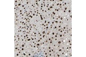 Immunohistochemical staining of human liver with USP36 polyclonal antibody  shows strong nuclear positivity in hepatocytes at 1:20-1:50 dilution. (USP36 Antikörper)