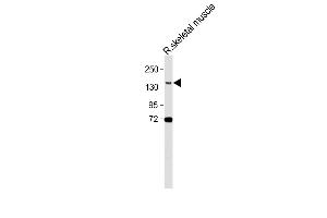 Anti-BCORL1 Antibody (N-term) at 1:500 dilution + Rat skeletal muscle lysate Lysates/proteins at 20 μg per lane. (BCORL1 Antikörper  (N-Term))