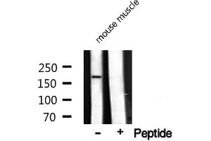Western blot analysis on mouse muscle lysate using TOP2A Antibody (Topoisomerase II alpha Antikörper  (Internal Region))