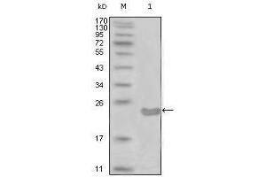 Western blot analysis using CD10 mouse mAb against truncated CD10-His recombinant protein (1).