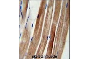 KI Antibody (Center) (ABIN654704 and ABIN2844396) immunohistochemistry analysis in formalin fixed and paraffin embedded human skeletal muscle followed by peroxidase conjugation of the secondary antibody and DAB staining. (KANSL3 Antikörper  (AA 398-427))