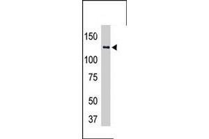 The USP25 polyclonal antibody  is used in Western blot to detect USP25-transfected HeLa cell lysates . (USP25 Antikörper  (C-Term))